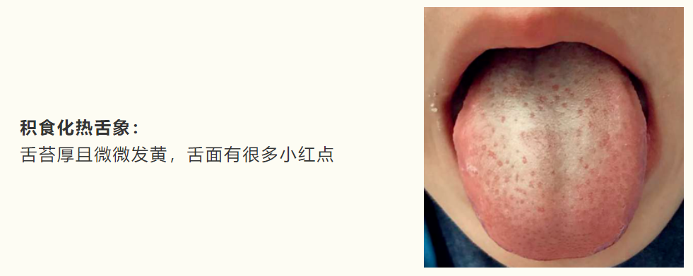 积食图3.png