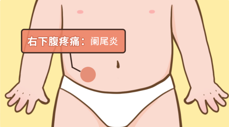 右下腹疼痛.png