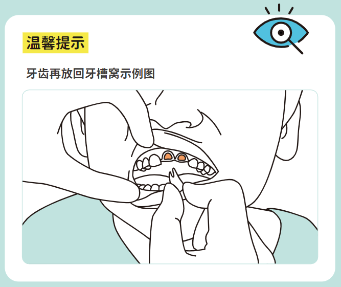 牙齿放回牙槽.jpg
