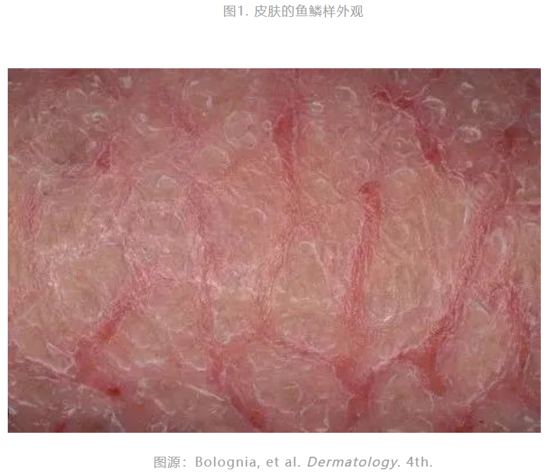 鱼鳞样外观，图1.png