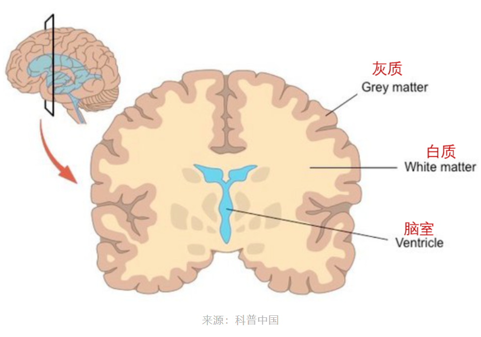 大脑，图1.png