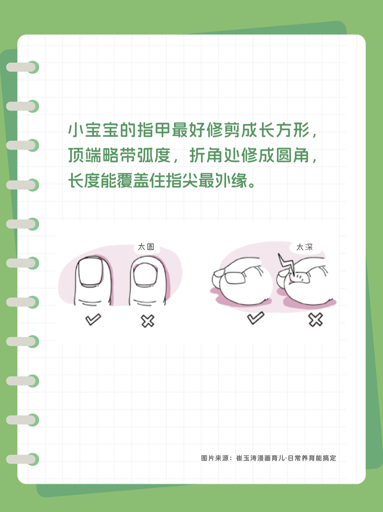 甲沟炎，图4.png