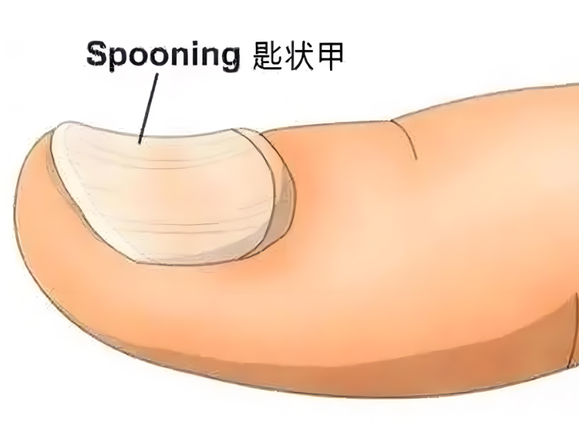 图8.png