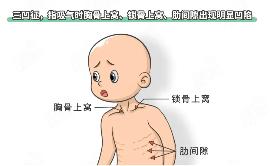 图3.png