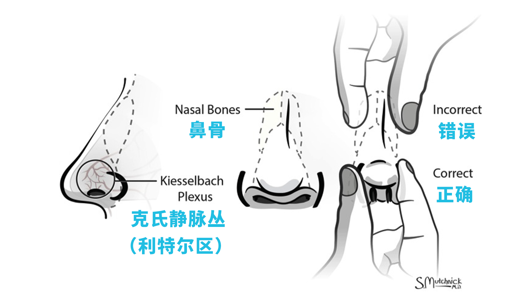 图3.png